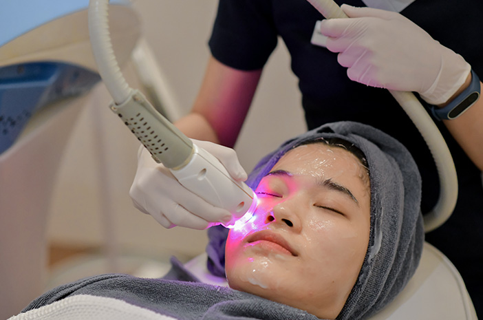 Seberapa Efektif Laser Wajah untuk Hilangkan Bekas Jerawat?